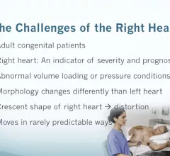 Dr. Michael Pfeiffer, a cardiologist and assistant professor of medicine at Penn State Hershey Heart and Vascular Institute in Hershey, Pa. discusses the advantages of 3D volume echocardiography in the right heart.