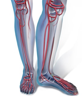 endovascular, critical limb ischemia, peripheral vascular disease - 25.79 Kb