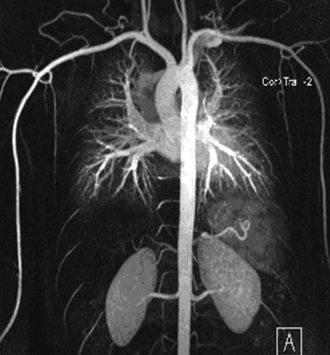 MR angiography, cardiac MR - 67.66 Kb