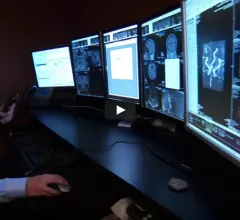 What to look for in radiology workflow orchestration software. Enterprise wide advanced visualization