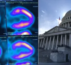 The American Society of Nuclear Cardiology (ASNC) is asking Congress to repeal the appropriate use software provision mandate, which physicians say is an obstacle to efficient care.