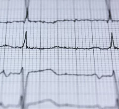heart health attack cardiology