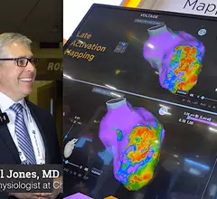 Sam Jones, MD, explains why CMS reduced payments for EP ablation and how it will negatively impact electrophysiology. #HRS #HRS2023 #EPeeps #EPlab #Medicare