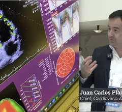 Video of Juan Carlos Plana Gomez MD explaining how to create a cardio-oncology program at ASE 2023. #ASE #ASE23 #ASE2023
