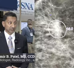Video of Samir Patel, MD, diagnostic radiologist at Radiology Inc., value management program founder and director and a board member of the Beacon Health System, explaining how AI is being implemented in mammography at RSNA 2023.