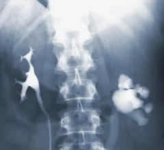 radiograph x-ray