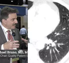 The rate of radiology reading errors has not changed in 75 years, despite technology advances, explains Michael Bruno, MD, Penn State Hershey Medical Center, who outlines the reasons why.