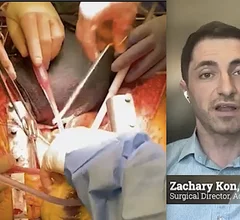 Zachary Kon, MD, surgical director, advanced heart failure and cardiac transplantation at Hofstra/Northwell, explains the current standard for collecting and preserving organs and a the new concept of thoracoabdominal normothermic regional perfusion (NRP)
