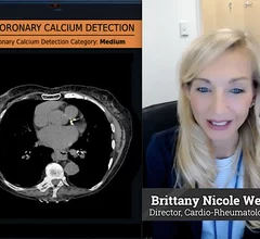  Brittany Nicole Weber, MD, Brigham and Women's Hospital, explains the use of opportunistic CT screening for cardiovascular disease on noncardiac exams. 