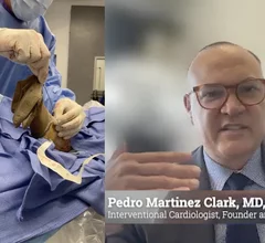 Video interview with Pedro Martinez Clark, MD, an interventional cardiologist, who explains how he overcame some key health disparities in Miami to make sure minority patients in low-income neighborhoods could receive screenings and care for peripheral artery disease (PAD).