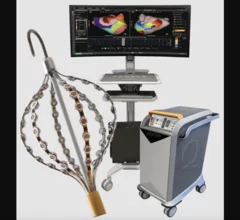 Acutus Medical, the California-based healthcare technology company focused on electrophysiology devices, has announced significant downsizing that will cut its workforce by approximately 70%. The goal of the move is to focus exclusively on manufacturing and distributing left-heart access devices as part of a distribution deal with Medtronic that was first signed in 2022. 