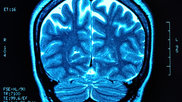 brain42.jpg