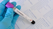 coronavirus_2.jpg
