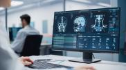 Monique Rasband, vice president of imaging, cardiology and oncology, KLAS Research, explains some of technology trends KLAS researchers have found in enterprise imaging system and radiology artificial intelligence (AI).