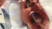 Model in the Abiomed booth showing placement of the Impella 5.5 liters per minute catheter heart pump. This is used for patients who need more support than a conventional Impella CP can offer, but does not require level of supported from ECMO.