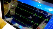 12-lead ECG EKG GE MAC VU360 ACC24.