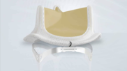 Edwards Lifesciences INSPIRIS RESILIA Aortic Valve
