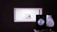 breast cancer mammography women's imaging 