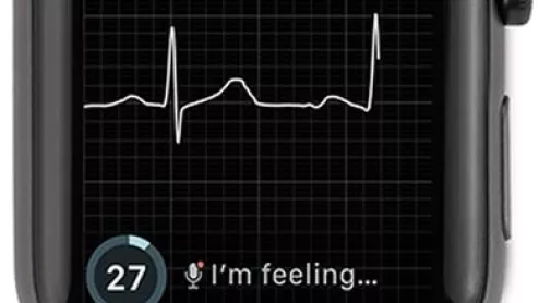 AliveCor's KardiaBand with Apple smartwatch