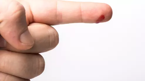 Finger stick | Blood