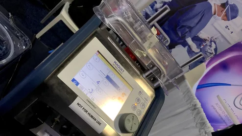 Getinge says it is ending production of its cardio-pulmonary surgical perfusion product in 2025, but plans to invest more in its Maquet Cardiosave ECMO system, which has continued market growth. Photo by Dave Fornell