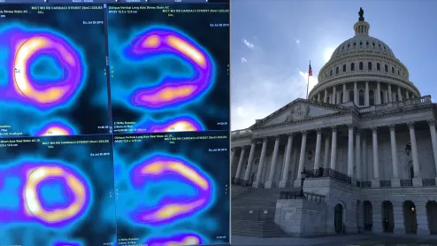 The American Society of Nuclear Cardiology (ASNC) is asking Congress to repeal the appropriate use software provision mandate, which physicians say is an obstacle to efficient care. American Society of Nuclear Cardiology is asking Congress now in June 2024 to officially repeal the appropriate use criteria requirement for admined medical imaging in a letter to Congress. Medicare rescinded the provision in 2024 Medicare Physician Fee Schedule, but the law remains on the books. 