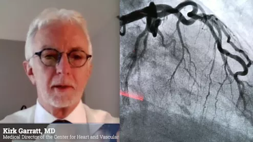 Kirk Garratt, past SCAI president, explains the impact of the iodine contrast shortage on interventional cardiology and the cath lab. #SCAI
