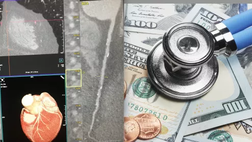 How to get paid, reimbursed, for cardiac CT, CTA CCTA. #SCCT #SCCT2022