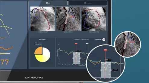 Medtronic CathWorks FFRangio FFR fractional flow reserve x-rays