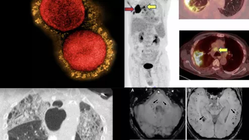 COVID-19 medical imaging examples of various clinical presentations. SARS-CoV-2 clinical imaging presentations.