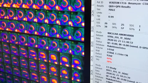 Cardiac SPECT nuclear imaging myocardial perfusion_Spectrum Dynamics_RSNA22_DF_3.jpeg