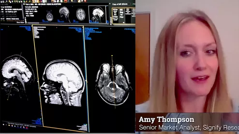 Amy Thompson, a senior analyst at Signify Research, explains what she is seeing in the market for radiology PACS. She said the biggest overall strategic technology trends are wider adoption of enterprise imaging systems expanding beyond radiology to include other departments, migration to cloud data storage, and adoption of artificial intelligence. Components of these integrate into the 5 trends in radiology IT systems outlined below.