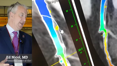 Ed Nicol, MD, consultant cardiologist and honorary senior clinical lecturer with Kings College London and president-elect of the Society of Cardiovascular Computed Tomography (SCCT), explained artificial intelligence (AI) in cardiac CT is here to stay and its use is expanding. He noted that one AI-based algorithm is already included in recent cardiology guidelines and more will likely follow. #SCCT