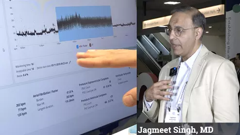 The proliferation of artificial intelligence (AI) in healthcare includes numerous algorithms for electrophysiology (EP). Jagmeet Singh, MD, Professor of Medicine, Harvard Medical School, and founding director of the Resynchronization and Advanced Cardiac Therapeutics Program and Mass General Hospital, spoke with Cardiovascular Business at Heart Rhythm 2023 to explain how AI is being used in EP. #HRS2023 #HRS #AI