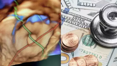 The Society for Cardiovascular Angiography and Interventions (SCAI), American College of Cardiology (ACC) and Heart Rhythm Society (HRS) have asked the U.S. Centers for Medicare and Medicaid Services (CMS) to clarify a key detail related to the national coverage determination (NCD) for percutaneous left atrial appendage closure (LAAC).