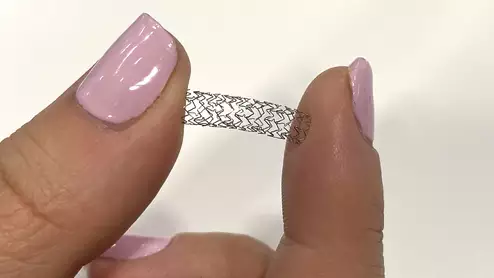 Patients receive unnecessary coronary stents during percutaneous coronary intervention (PCI) procedures at an alarming rate, according to a new report from the Lown Institute. The analysis included approximately 1 million stent procedures performed at more than 1,700 U.S. hospitals and outpatient facilities from 2019 to 2021.