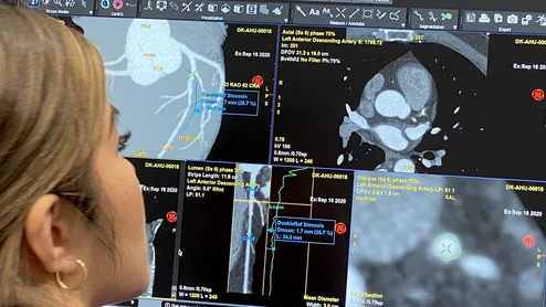 GE Healthcare's CardIQ Suite offers AI to help automated cardiac CT assessments, including measurement of vessels and anatomy, visualization of chamber mobility, plaque imaging and calcium scoring. Photo by Dave FornellCoronary CCTA cardiac CT training for interventional cardiologists, GE session at TCT 2023. Photo by Dave Fornell