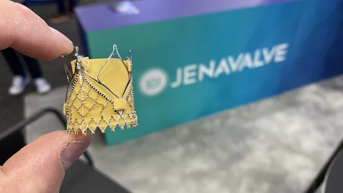jenavalve TAVR valve for aortic regurgitation acquired by Edwards