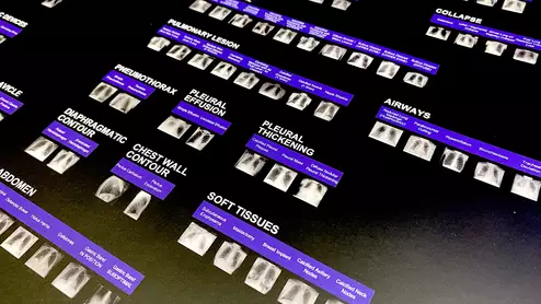AI applications developed by Annalise.ai and commercialized outside the U.S. The company is working on gaining FDA for these and had several FDA clearances granted this past year. Photo by Dave Fornell. #RSNA #RSNA23 #RSNA2023