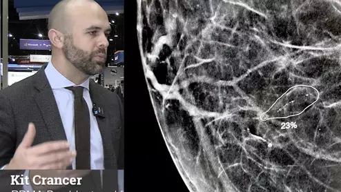 Video interview with Radiology Business Management Association (RBMA) President Kit Crancer, and executive director of the Rayus Quality Institute, where he said the lack of federal policy on insurance coverage for diagnostic breast exams as opposed to screening exams