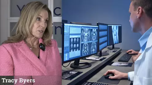 Video of Tracy Byers, CEO, Change Healthcare, explaining trends in the PACS market at RSNA 2023. #RSNA #enterpriseimaging #PACS #HealthIT