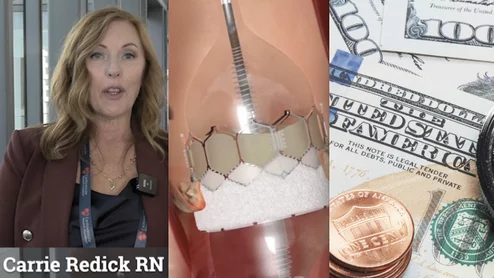 Carrie Redick RN MSN NEA-BC, director of interventional cardiology and structural heart, Morristown Medical Center, Atlantic Health System, explains the need for financial literacy among structural heart program directors at the Transcatheter Cardiovascular therapeutics (TCT) 2023 meeting.