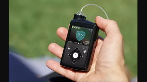 Medtronic’s MiniMed 780G automated insulin delivery system