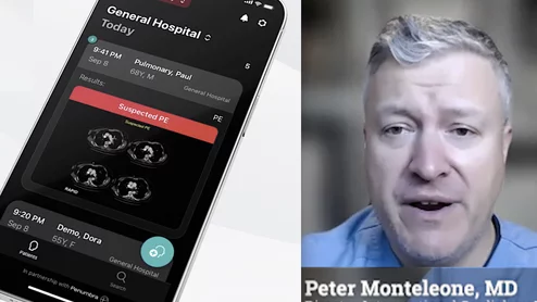 Peter Monteleone, MD, an interventional cardiologist, national director of cardiovascular research at Ascension Health, and assistant professor, UT Austin Dell School of Medicine, explained the use of artificial intelligence (AI) to independently identify an emergency stroke or pulmonary embolism (PE) finding on a CT scan and automatically alert critical care team members. His health system uses this type of AI for earlier activation of the pulmonary embolism response team (PERT).