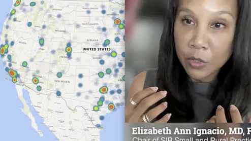 Elizabeth Ann Ignacio, MD, FSIR, FACR, the chair of Society of Interventional Radiology (SIR) Small and Rural Practices Committee, president of the Hawaii Medical Association, and a board member of the American College of Radiology, outlines the shortage of IRs outside of major cities and ways to make these positions more attractive.