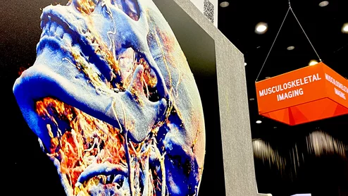 Art by Maki Sugimoto. MSK Musculoskeletal head and neck CT 3D reconstruction art radiology RSNA 2024.