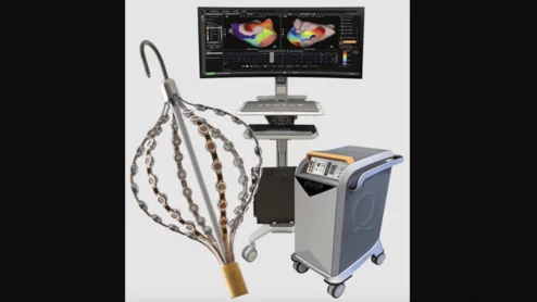 Acutus Medical, the California-based healthcare technology company focused on electrophysiology devices, has announced significant downsizing that will cut its workforce by approximately 70%. The goal of the move is to focus exclusively on manufacturing and distributing left-heart access devices as part of a distribution deal with Medtronic that was first signed in 2022.