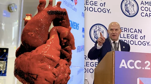 Chris Kramer ACC president will be moderating a global state of health meeting to help the UN better understand the need for investing in preventive care healthcare workers.