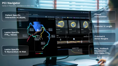 Heartflow PCI Navigator Cardiology. PCI Navigator from Heartflow was designed to help cardiologists plan ahead for percutaneous coronary interventions before they even step foot into the cath lab. It assesses a patient’s CCTA results and creates a state-of-the-art 3D model.