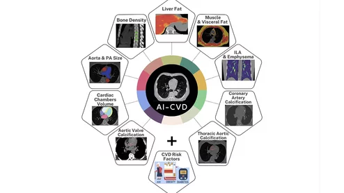 The U.S. Food and Drug Administration (FDA) has cleared HeartLung Corporation's AI-CVD, an artificial intelligence (AI) algorithm that looks at 11 different opportunistic health screening assessments on chest CT exams ordered for any reason.